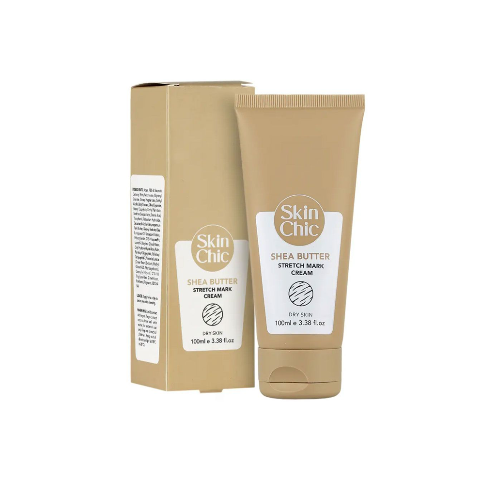 Shea-Butter-Stretch-Mark-Cream-SKIN-CHIC1